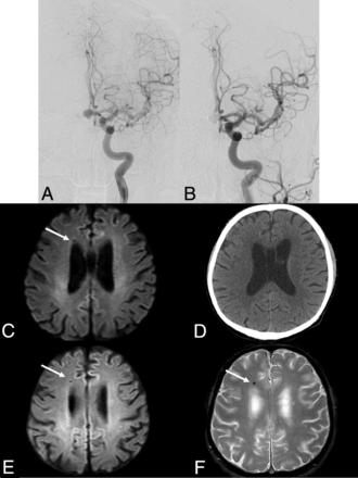 Fig 2.