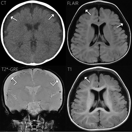Fig 3.
