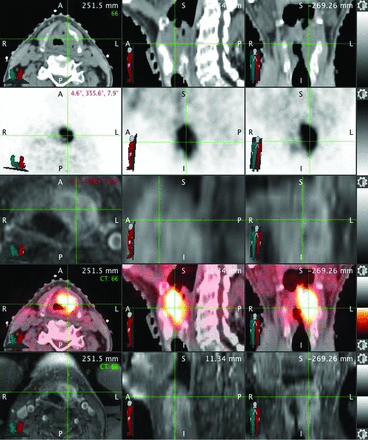 Fig 2.