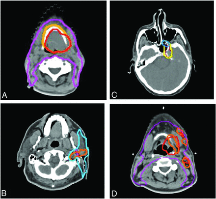 Fig 5.