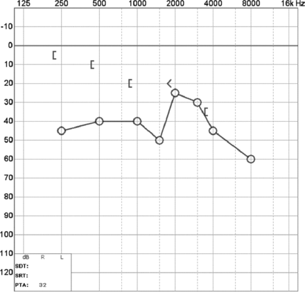 Fig 10.