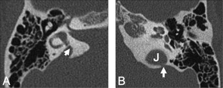Fig 13.