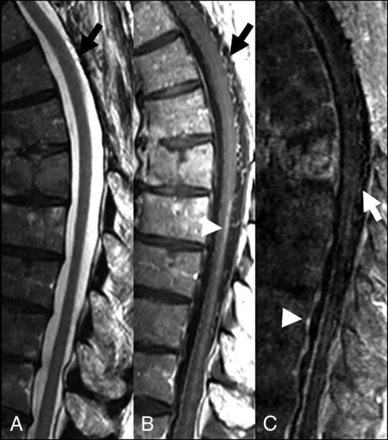 Fig 3.