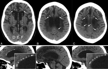 Fig 1.