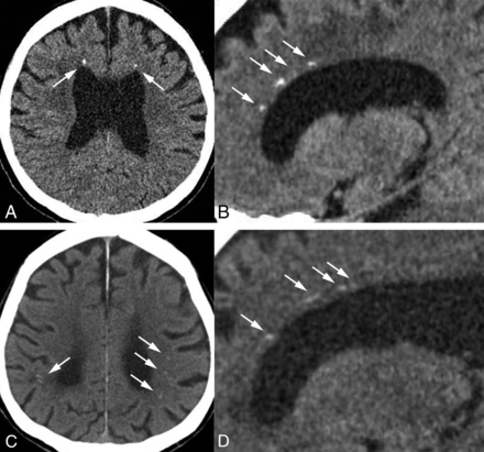 Fig 3.
