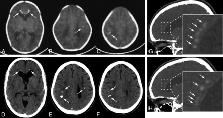 Fig 4.