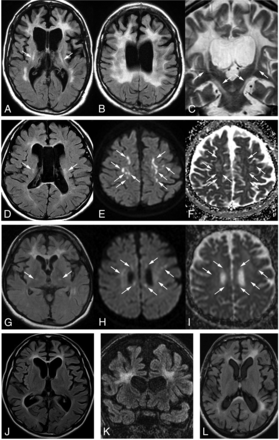 Fig 5.