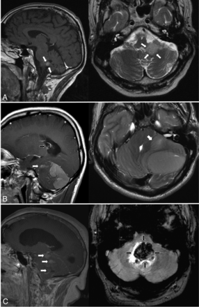 Fig 1.