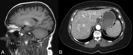 Fig 2.