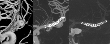 Fig 1.
