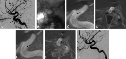 Fig 4.