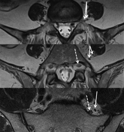 Fig 3.