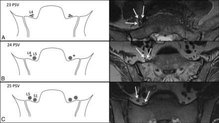 Fig 4.