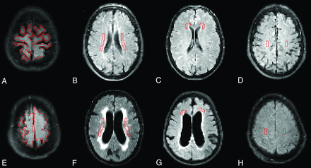 Fig 3.
