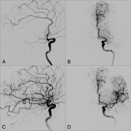 Fig 3.