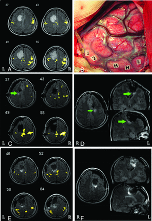Fig 2.