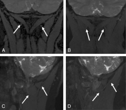 Fig 1.