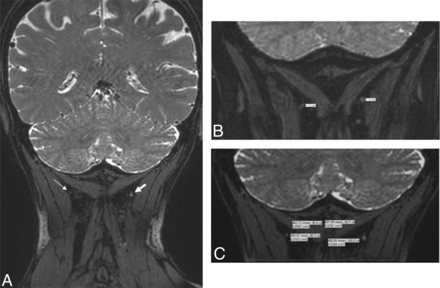 Fig 2.