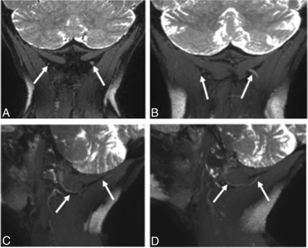 Fig 4.