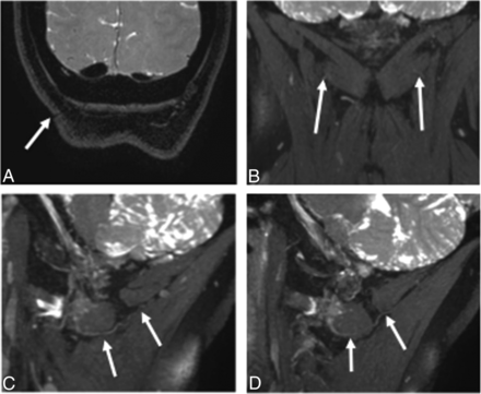 Fig 5.