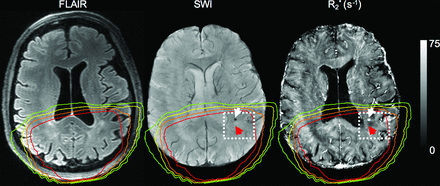 Fig 3.