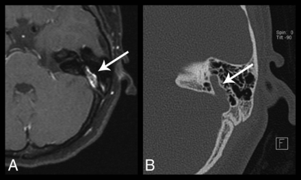 Fig 10.