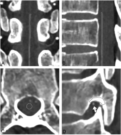 Fig 2.