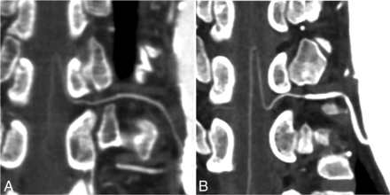 Fig 6.
