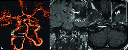 Fig 4.