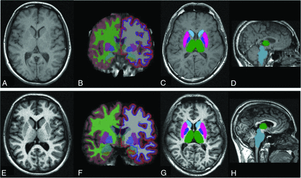 Fig 1.