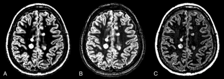 Fig 1.