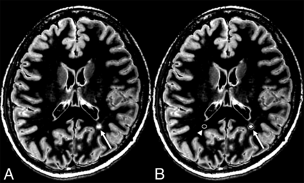 Fig 3.