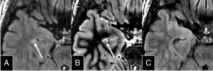 Fig 5.