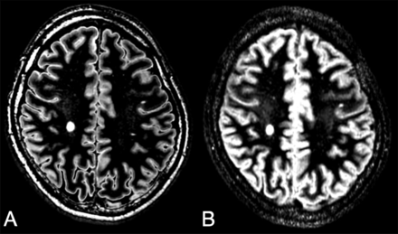 Fig 6.