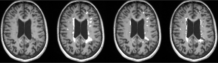 Fig 1.