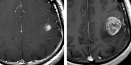 Fig 3.