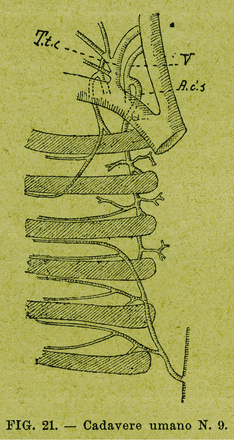 Fig 13.