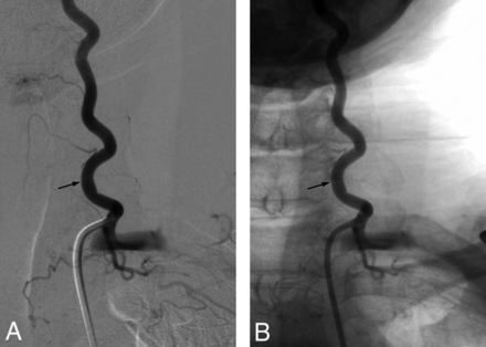 Fig 14.