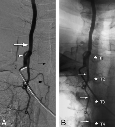 Fig 3.
