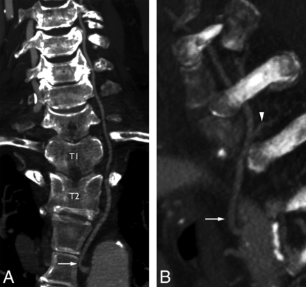 Fig 8.