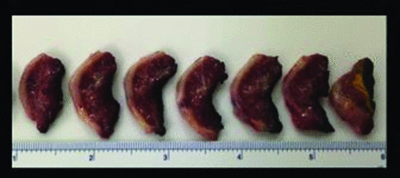 Fig 2.