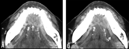 Fig 3.