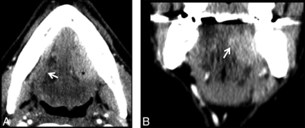 Fig 4.