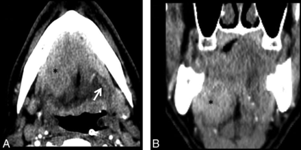 Fig 5.