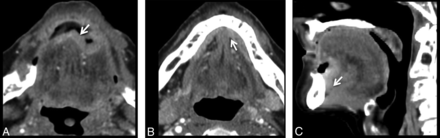 Fig 7.