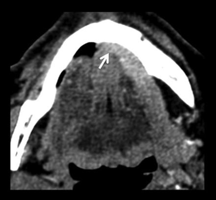 Fig 8.