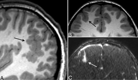 Fig 2.