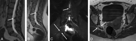 Fig 1.