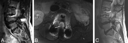 Fig 2.