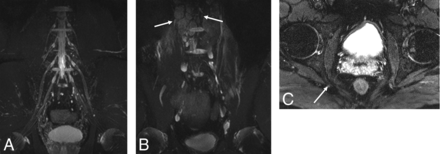 Fig 3.